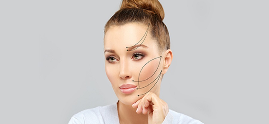 Thread-lift-Facial-Rejuvenation