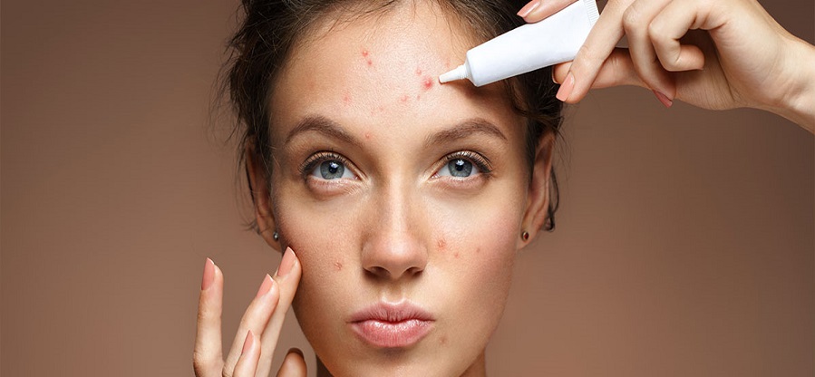 drug-induced-acne