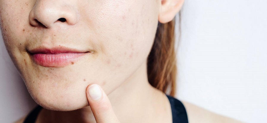 how-to-unclog-pores
