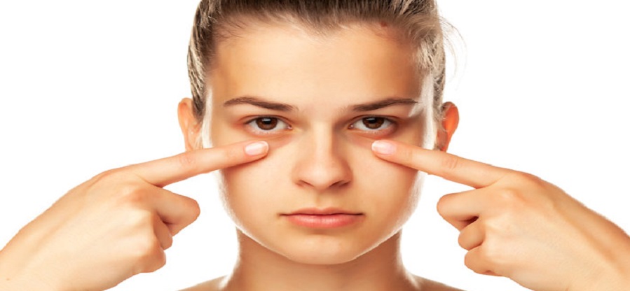 قرص برای رفع سیاهی دور چشم
