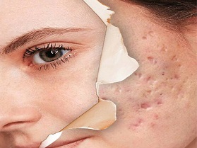 استفاده از کرم ترمیم کننده