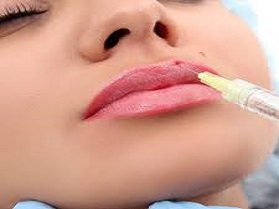 تزریق بوتاکس به لب ها
